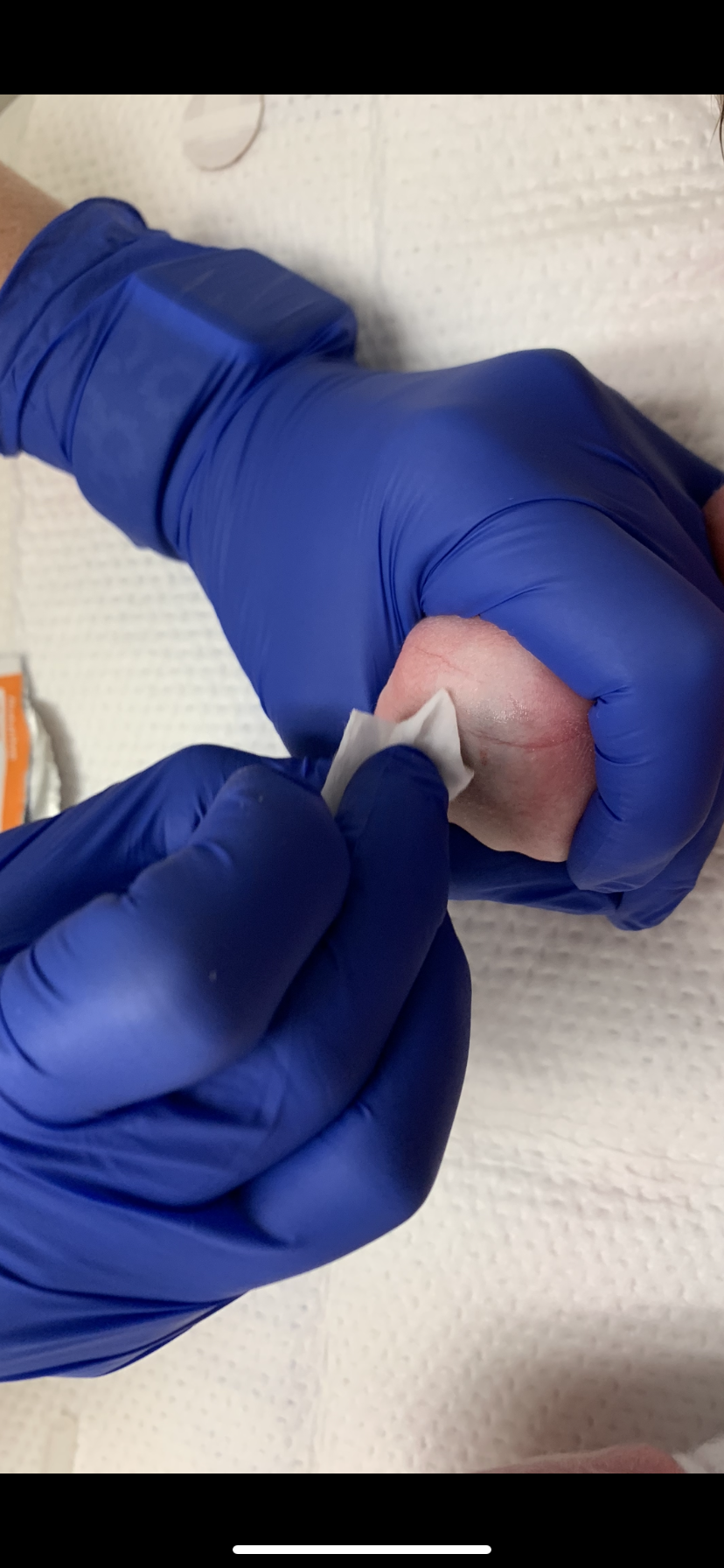 Clean with alcohol.PNG