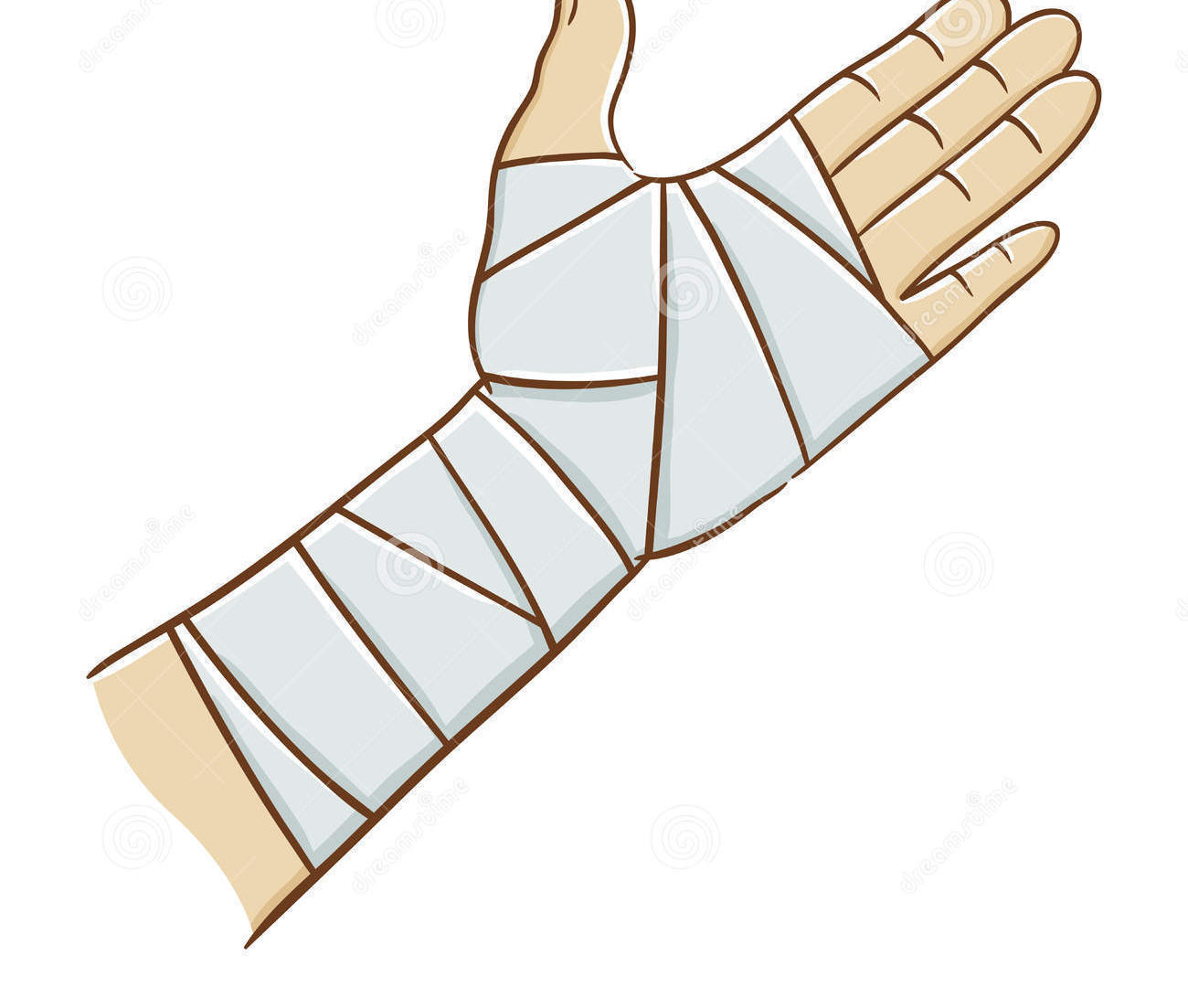 How to Splint Wrist