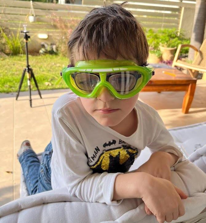 Glasses Inside a Swimming Glasses for Michael - Michael Had His Lenses Removed, Following a Dislocation of the Lenses Caused by Marfan Syndrome.