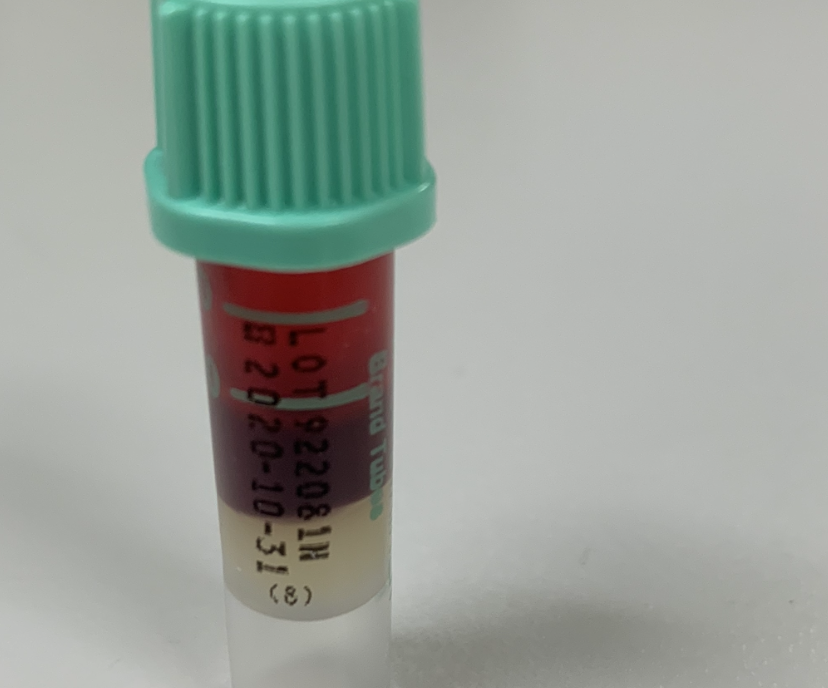 How to Draw a Venous Bilirubin- Neonate