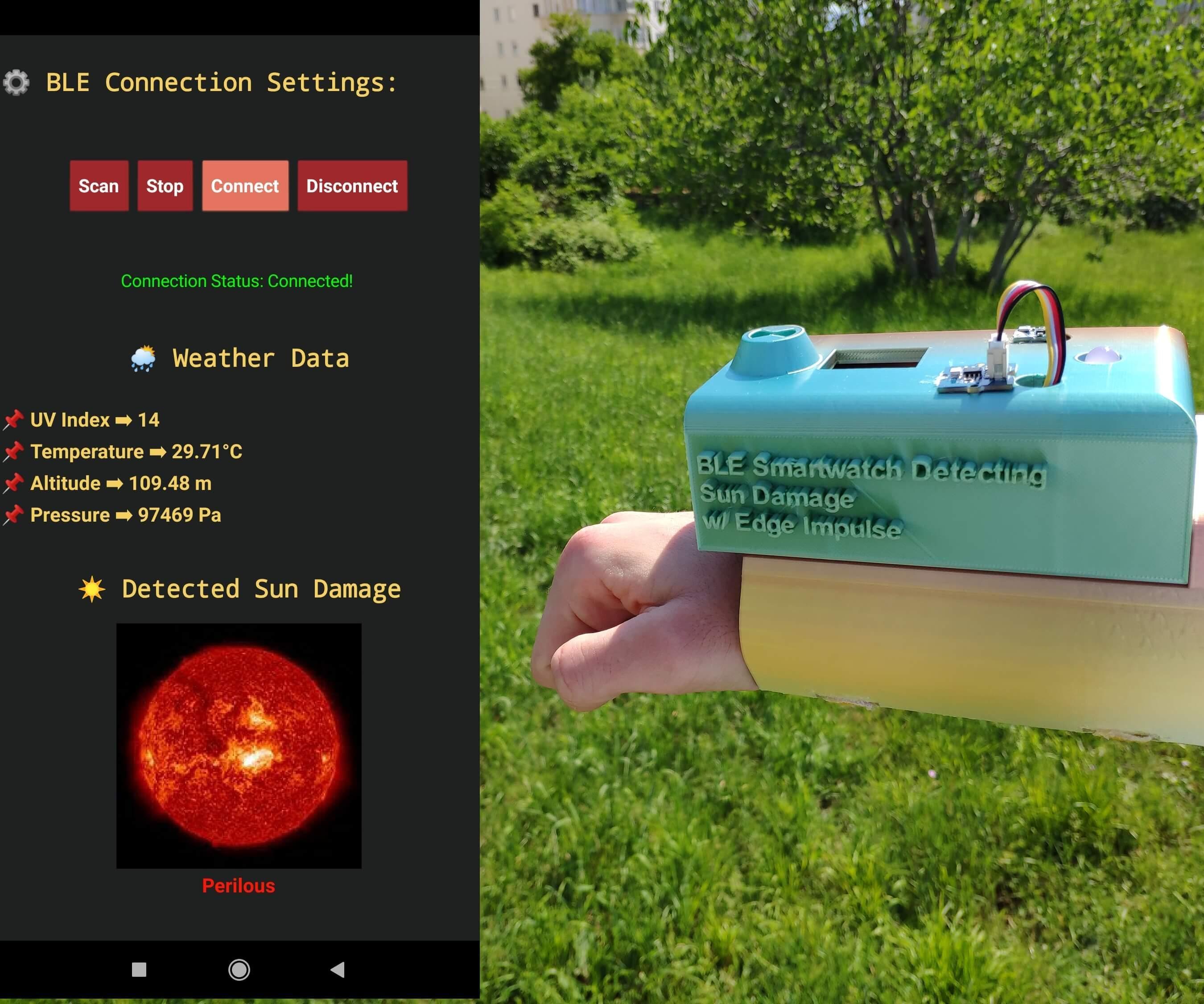 BLE AI-driven Smartwatch Detecting Potential Sun Damage