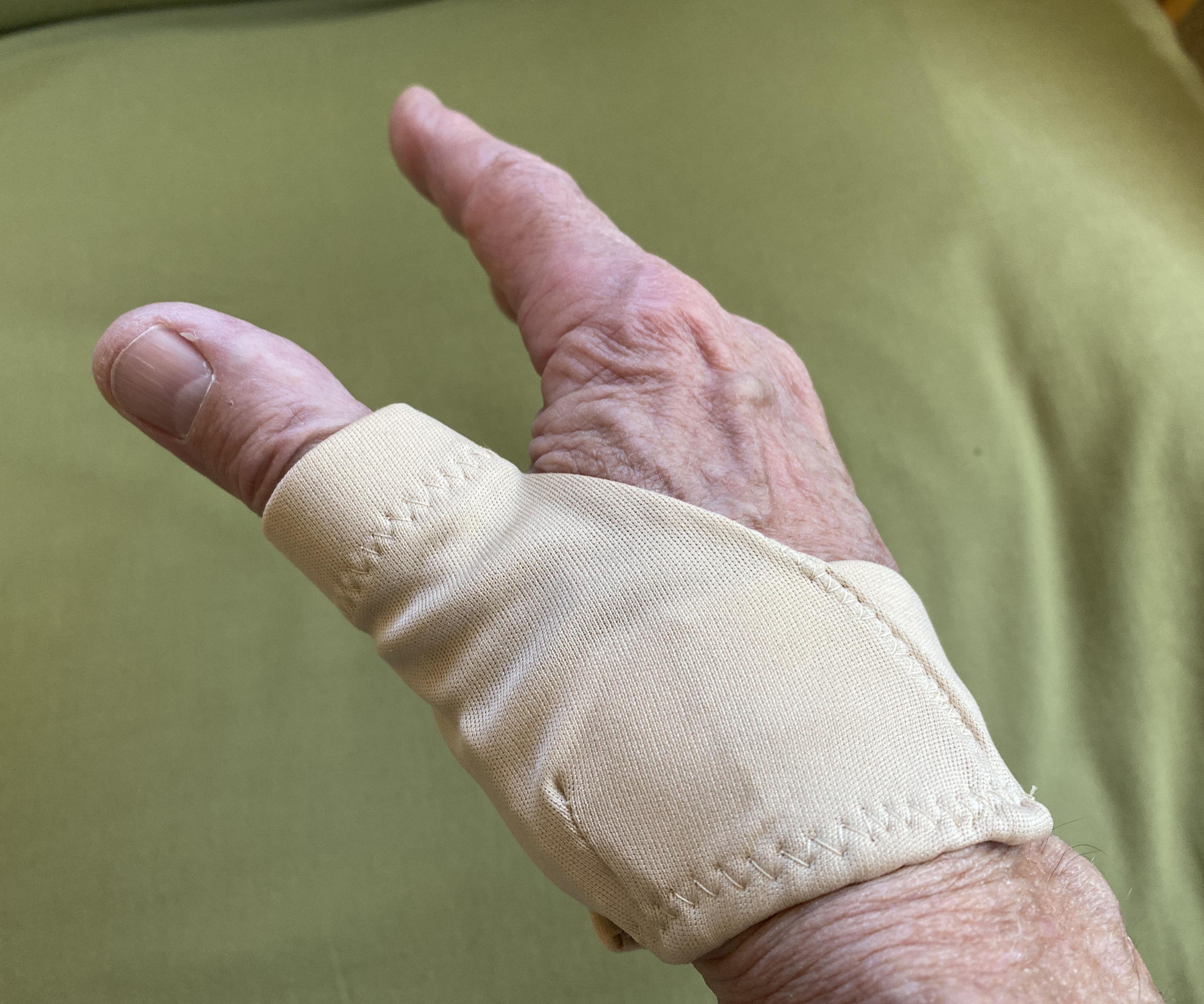 Make a Splint for Your Sore Thumb Joint