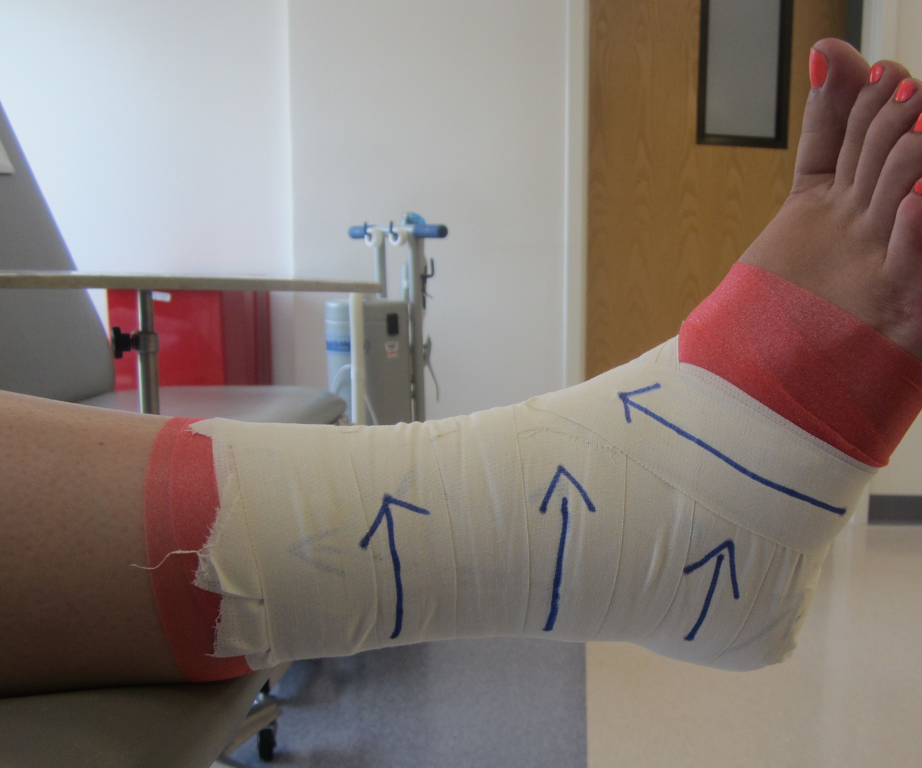 How to Tape an Ankle 