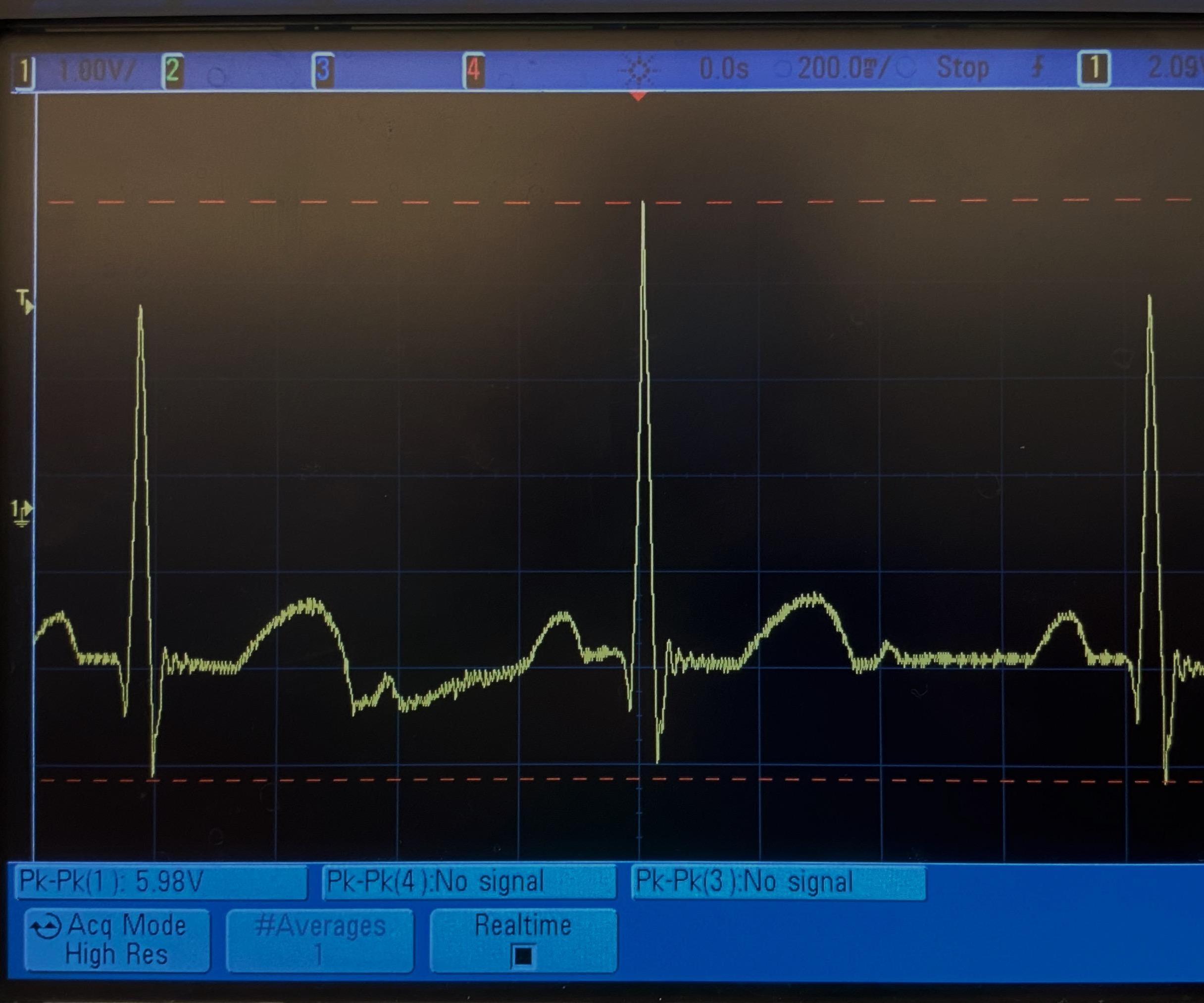 Electrocardiogram (ECG) Circuit Design