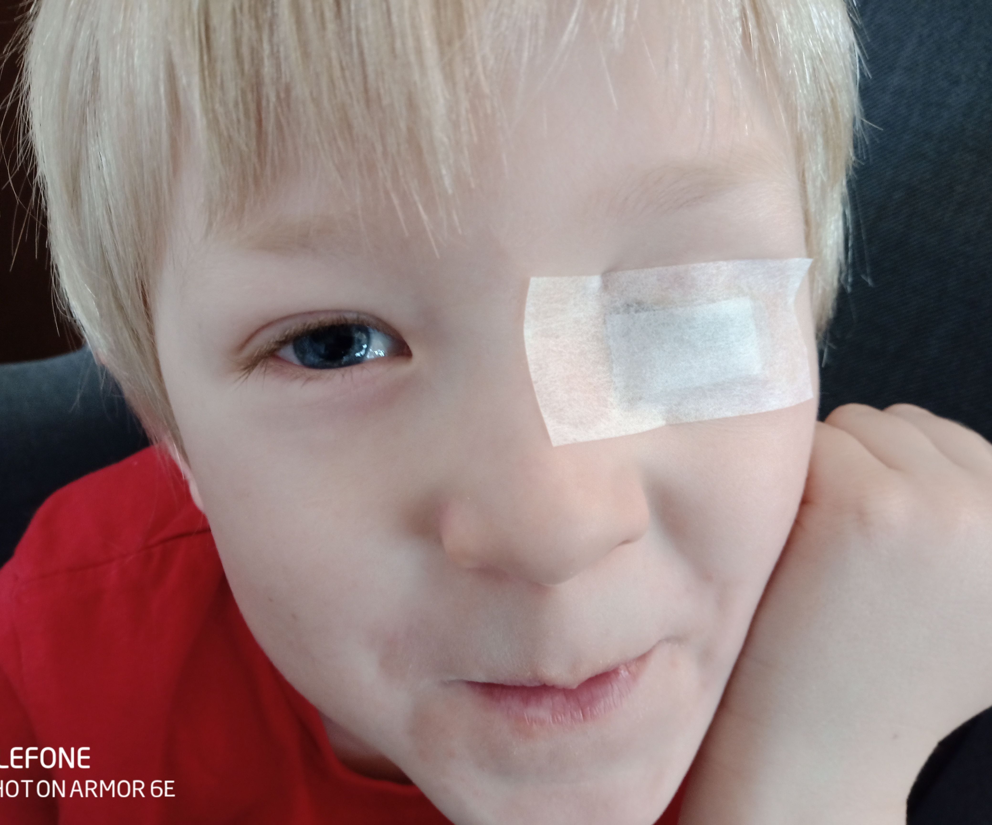 Easy Amblyopia Eye Patch - and Teaching Kids Money Saving 